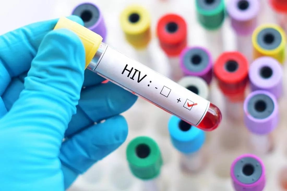 HIV drugs running out and 3 patients are compelled to