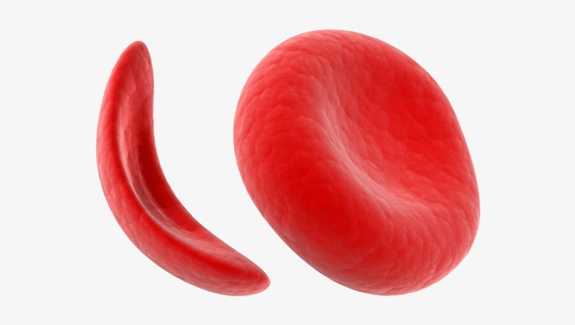 Treating Sickle Cell Anaemia - Rafamall